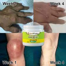 🐝 Beevana Crema para Dolores y Articulaciones – ¡Dile adiós al dolor de forma natural! 🌿